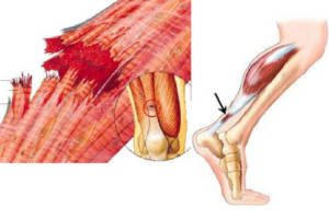 Cuál es la diferencia entre músculos tendones y ligamentos